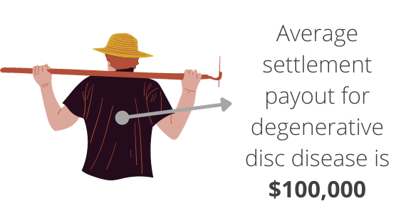 Average settlement payout for degenerative disc disease