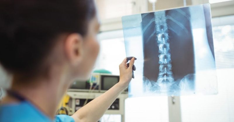 medical professional investigates x-ray